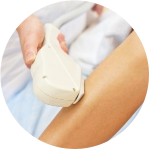 Лазерная эпиляция рук